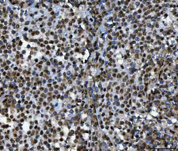 TIP49A/RUVBL1 Rabbit Polyclonal Antibody