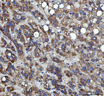 RRS1 Antibody