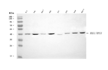 RRS1 Antibody