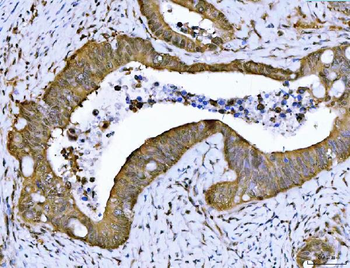 PSMB4 Rabbit Polyclonal Antibody