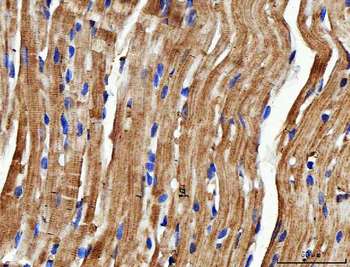 NDUFS6 Rabbit Polyclonal Antibody