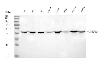 NDUFS2 Rabbit Polyclonal Antibody