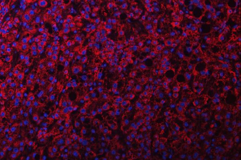 NDUFS2 Rabbit Polyclonal Antibody