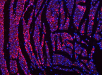 NDUFS2 Rabbit Polyclonal Antibody