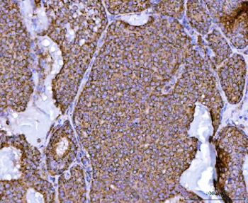 NDUFS2 Rabbit Polyclonal Antibody