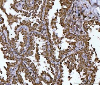 NDUFS2 Rabbit Polyclonal Antibody