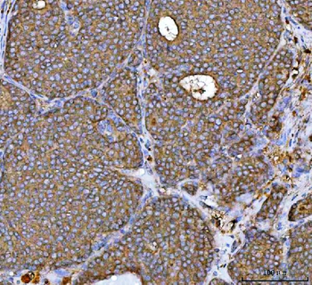 MRPS22 Rabbit Polyclonal Antibody