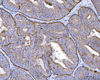 MRPS22 Rabbit Polyclonal Antibody