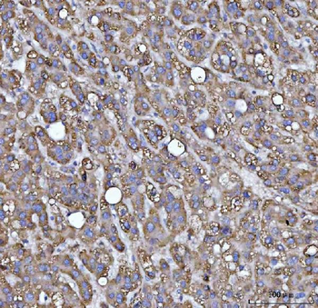 MRPS22 Rabbit Polyclonal Antibody