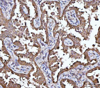 MRPS22 Rabbit Polyclonal Antibody