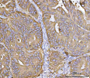 MRPS22 Rabbit Polyclonal Antibody