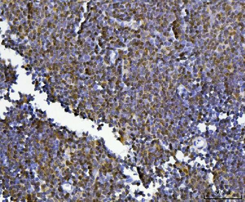 KLF13 Rabbit Polyclonal Antibody