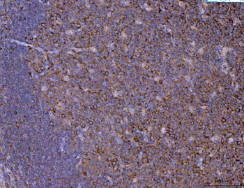 Eg5/KIF11 Rabbit Polyclonal Antibody