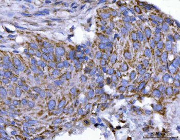 EIF3A Rabbit Polyclonal Antibody
