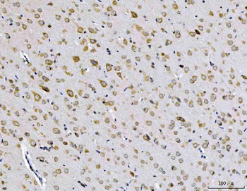EIF3A Rabbit Polyclonal Antibody