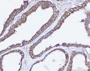 Carbonic Anhydrase 9/CA9 Rabbit Polyclonal Antibody