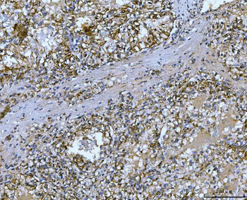 Carbonic Anhydrase 9/CA9 Rabbit Polyclonal Antibody