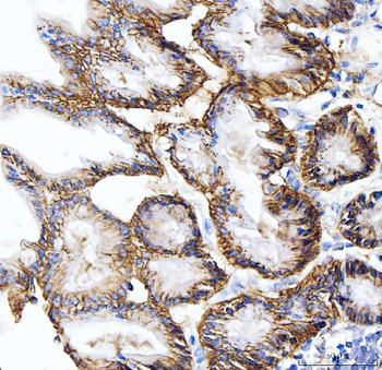 Carbonic Anhydrase 9/CA9 Rabbit Polyclonal Antibody