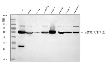 ATP5F1A Rabbit Polyclonal Antibody