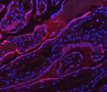 ATP5F1A Rabbit Polyclonal Antibody