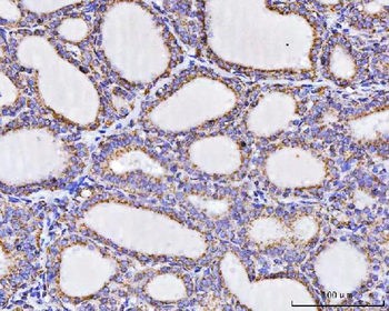 ATP5F1A Rabbit Polyclonal Antibody