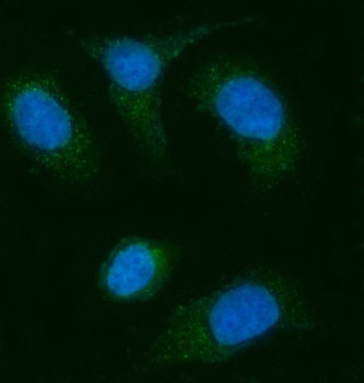 AGPS Rabbit Polyclonal Antibody