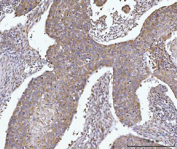 AGPS Rabbit Polyclonal Antibody