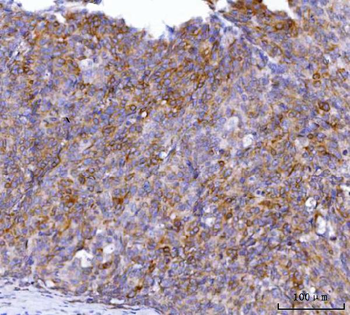 AGPS Rabbit Polyclonal Antibody