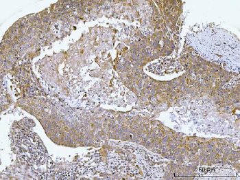 AGPS Rabbit Polyclonal Antibody