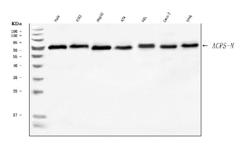 AGPS Rabbit Polyclonal Antibody