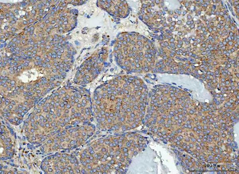 RPL32 Rabbit Polyclonal Antibody