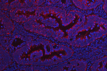 NDUFV2 Rabbit Polyclonal Antibody