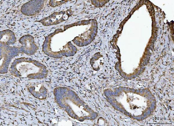 NDUFV2 Rabbit Polyclonal Antibody