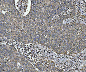 NDUFV2 Rabbit Polyclonal Antibody