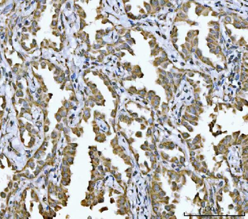 NDUFV2 Rabbit Polyclonal Antibody