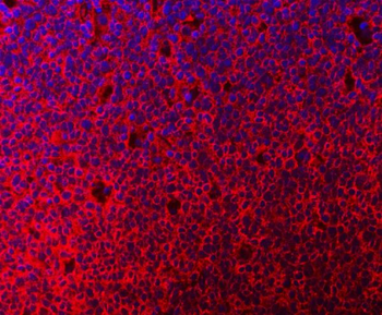 MTHFD1 Rabbit Polyclonal Antibody