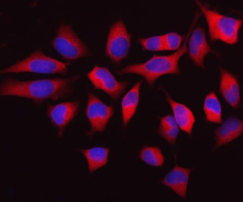 MTHFD1 Rabbit Polyclonal Antibody