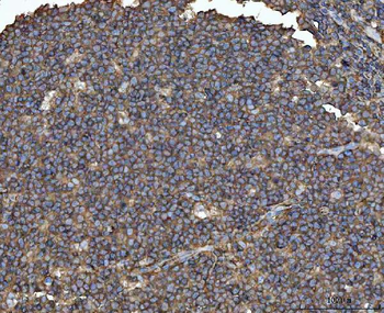 MTHFD1 Rabbit Polyclonal Antibody