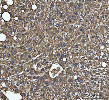 MTHFD1 Rabbit Polyclonal Antibody