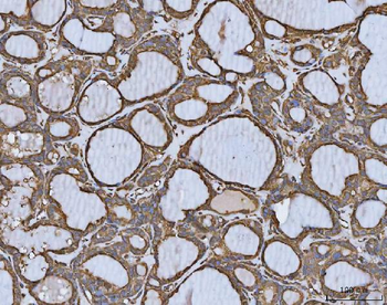 MTHFD1 Rabbit Polyclonal Antibody