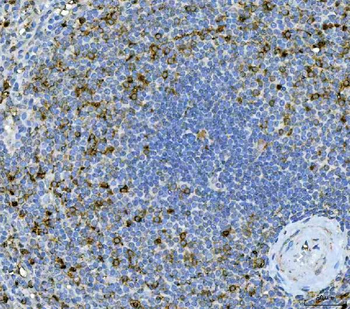 IL17A Rabbit Polyclonal Antibody