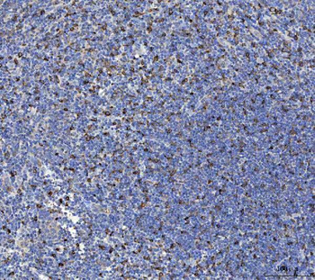 IL-10/IL10/IL Rabbit Polyclonal Antibody