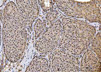 HOXC4 Rabbit Polyclonal Antibody
