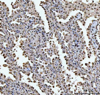 HOXC4 Rabbit Polyclonal Antibody