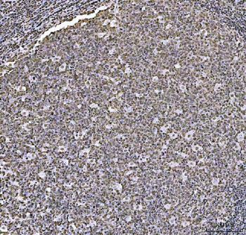 HOXC4 Rabbit Polyclonal Antibody