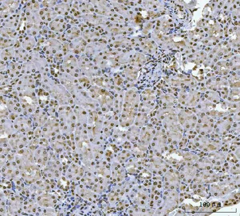 HOXC4 Rabbit Polyclonal Antibody