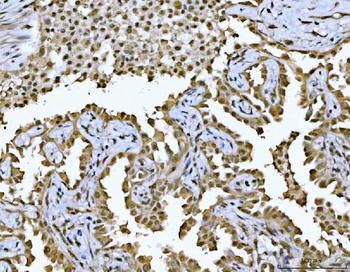 HDAC1 Rabbit Polyclonal Antibody