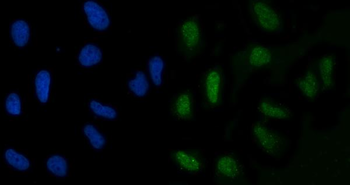 GLIS1 Rabbit Polyclonal Antibody