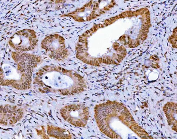 GLIS1 Rabbit Polyclonal Antibody