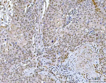 GLIS1 Rabbit Polyclonal Antibody